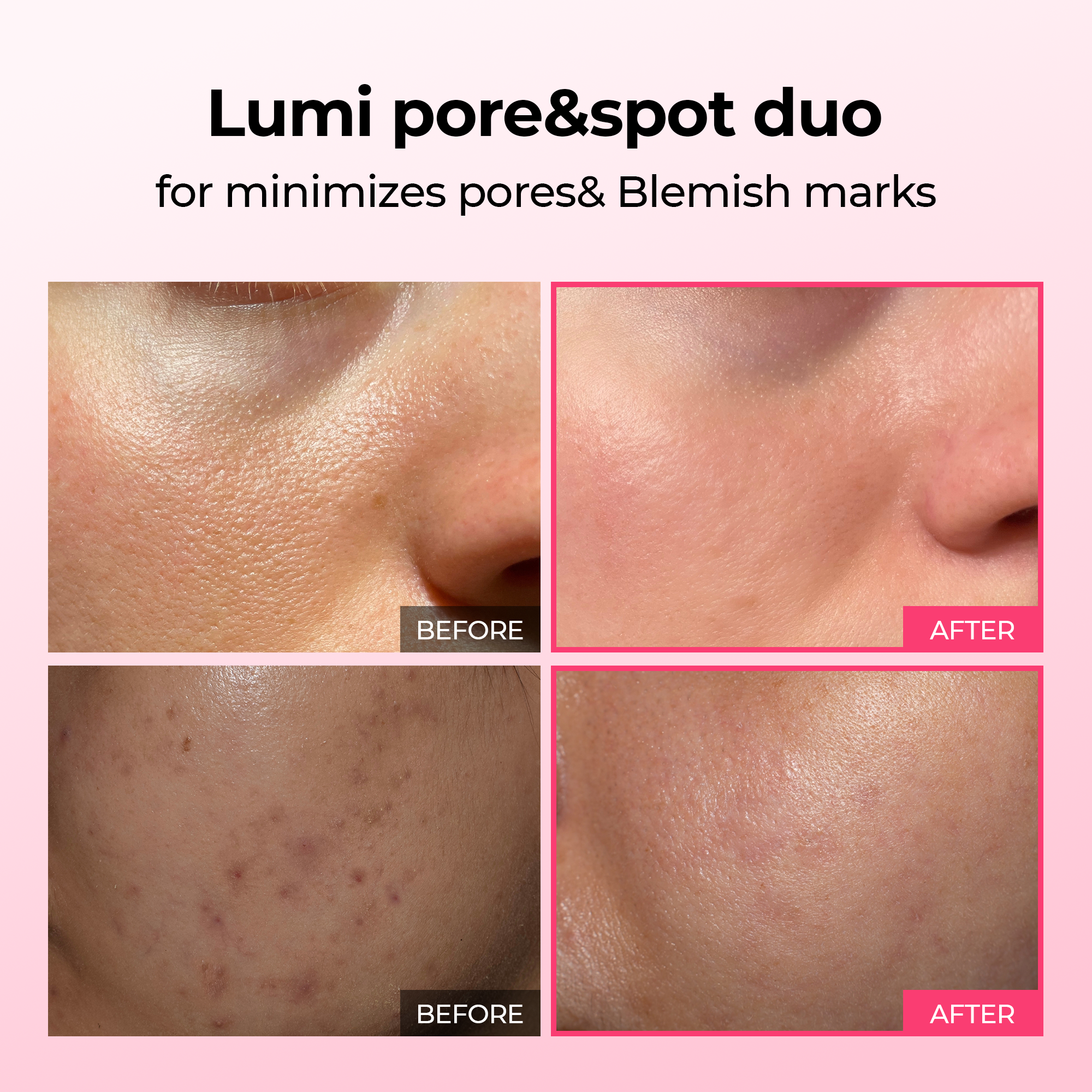 Lumi Pore & Spot Care Duo